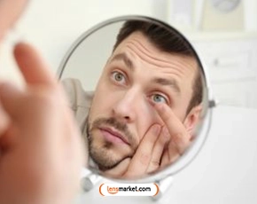 Multifokal Lensler Hakkında Sık Sorulan Sorular